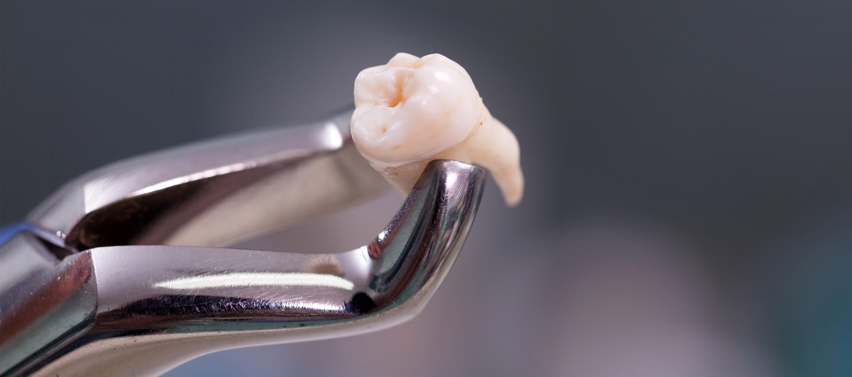 Oral surgery. 